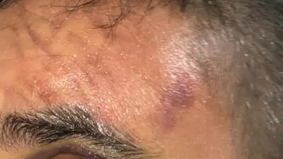 Afyonkarahisar'da 3 Kişinin Saldırısı: İş Yeri Sahibi Gözünü Kaybetme Tehlikesi Yaşadı