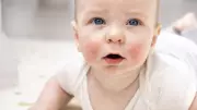 Bebeklerde İsilik Sorunuyla Başa Çıkmanın Püf Noktaları: Rahat Bir Yaz İçin!