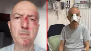 Boşanma Sürecindeki Adamın Başına Gelenler: Evden Atıldı, Burnu Kırıldı!