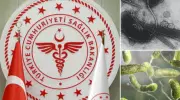 Türkiye'de Et Yiyen Bakteri Alarmı! Sağlık Bakanlığı'ndan Kritik Açıklama Geldi