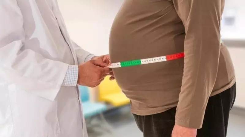 Obezite Salgını Ekonomiyi Nasıl Kemiriyor? Şaşırtıcı Maliyetler Ortaya Çıktı!