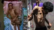 Gazze'de Açlık Felaketi: Son 24 Saatte 3 Can Daha Gitti, Biri Masum Bir Çocuk!