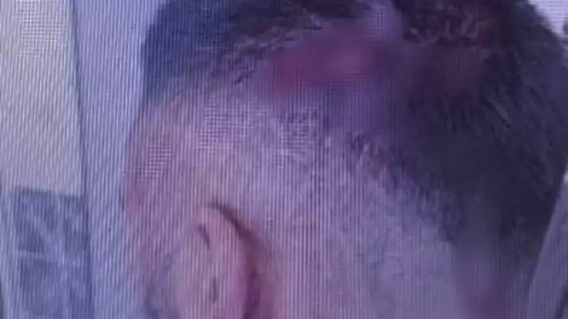 Şanlıurfa'da Öğretmene Sopayla Saldırı: Eğitim Emekçisi Korkunç Bir Andan Sağ Kurtuldu