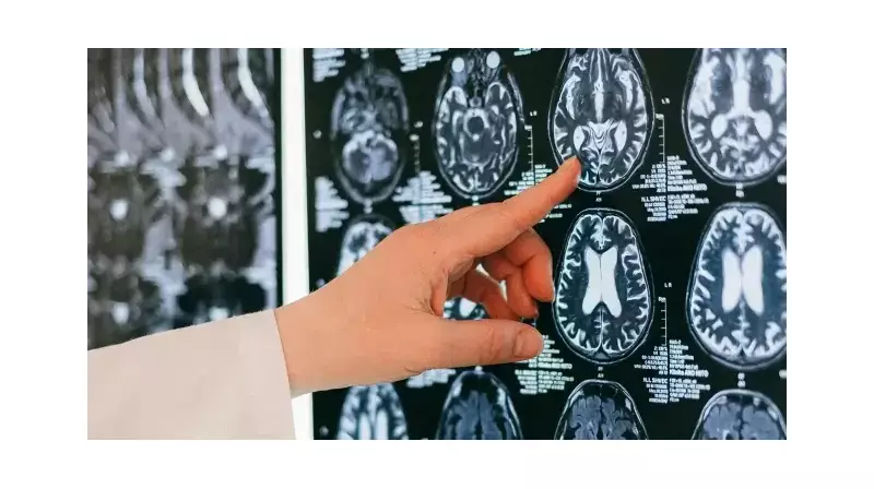 Beyin Sisine Dikkat! Günlük Hayatınızı ve İş Performansınızı Ele Geçirebilir