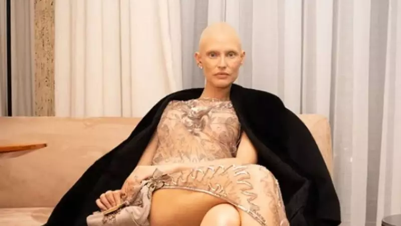 Bianca Balti'nin Dramı: İtalyan Modelin Kariyeri Tehlikede Mi?