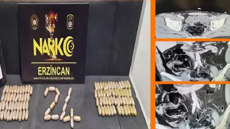 Erzincan'da Şok Operasyon: Bir İnsanın Midesinden ve Bağırsaklarından Neredeyse 1 Kilo Yabancı Cisim Çıktı!
