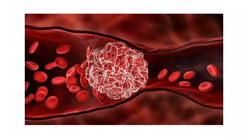Kan Pıhtısı Riskini Azaltmanın Sırrı: Düzenli Egzersiz ve Doğru Beslenme