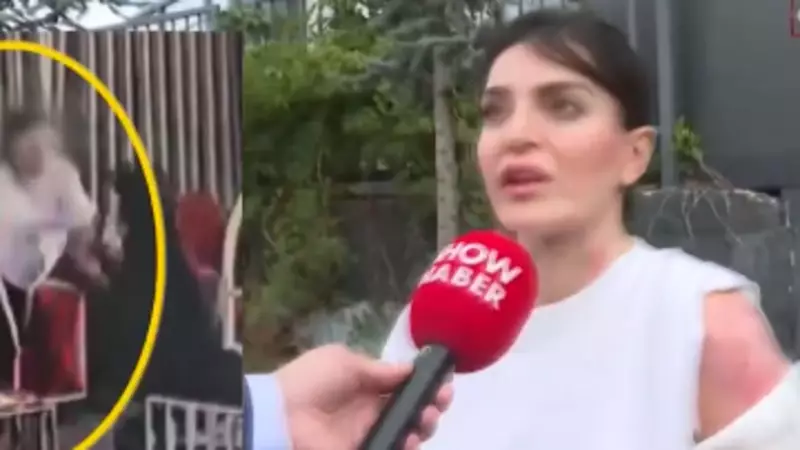 Kaynar Kahveyle Yakan Kişiye Şok İtiraf: 'Beni Kıskanmış Olmalı'