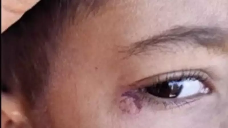 Okulda Dehşet: Öğrencinin Yüzünde Sigara Söndüren Temizlikçiye Hapis!