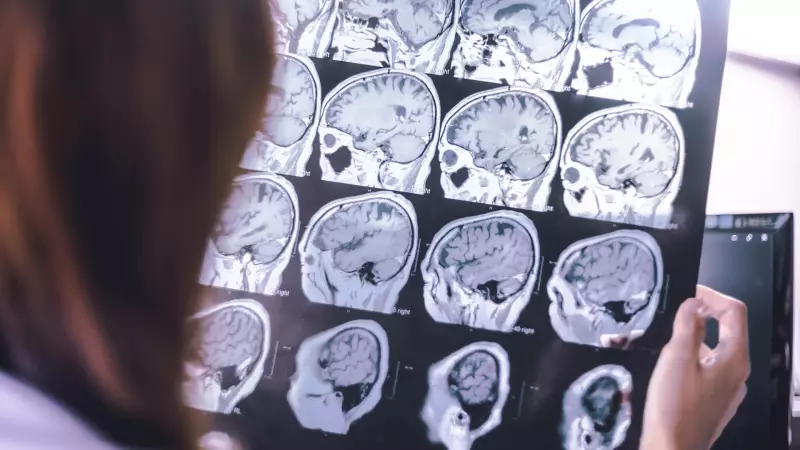 Parkinson Gizli Tehlike: Birleşik Krallık'ta 20 Bin Kişi Hastalığın Farkında Bile Değil!