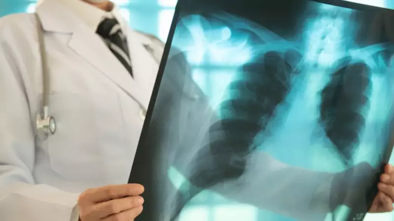 Akciğer Kanseri Teşhisi: Erken Tanı Hayat Kurtarıyor