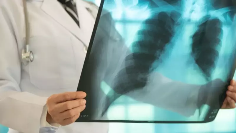 Akciğer Kanserinde Görünmez Tehlike: Sadece İçen Değil, Çevresindekiler de Risk Altında!