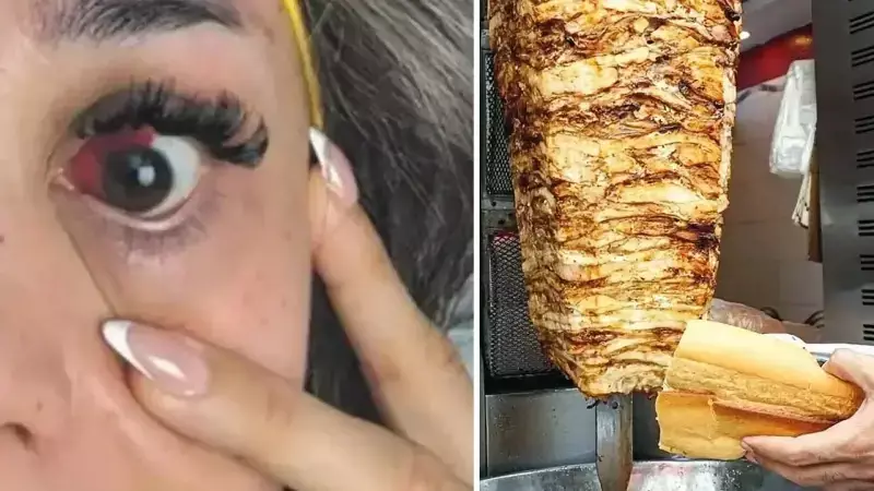 Çağlayan'da Tavuk Döner Zehirlenmesi: 35 Yaşındaki Kadın Görme Kaybı Riski Yaşadı