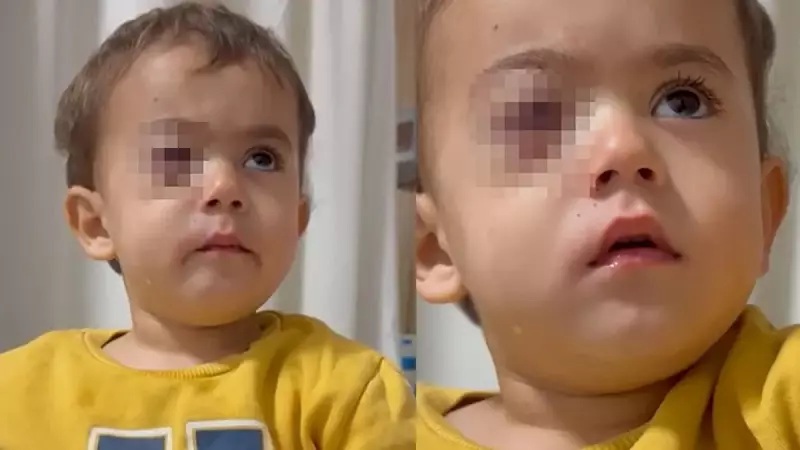 Bursa'da Torpil Faciası: 2 Yaşındaki Alparslan'ın Gözüne İsabet Etti