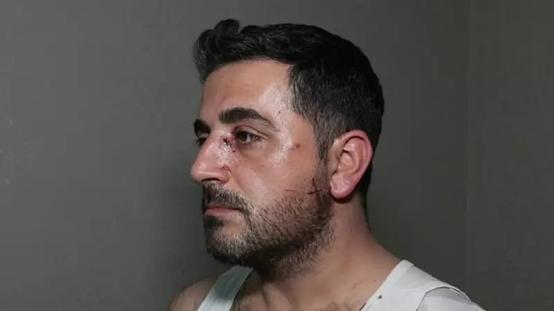 Esenyurt'ta Kiralık Dehşet: Banyodan Çıktı, Hayatının Şokunu Yaşadı!