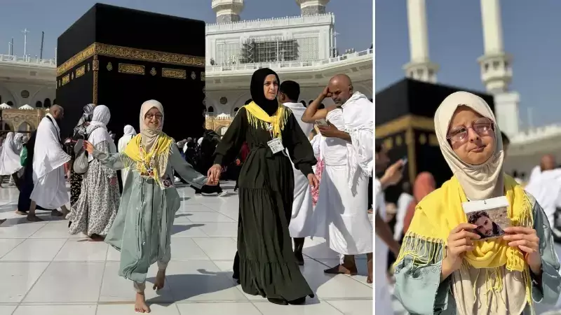 Hallermann-Streiff Sendromlu Esma'nın Kabe Hayali Gerçek Oldu