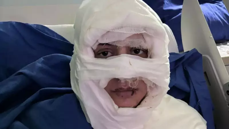 Kıskandığı Genç Kadını Yakan Kadın Tutuklandı