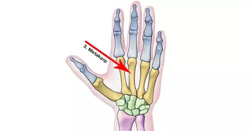 Metakarpal Kemikler: Elinizdeki 5 Tarak Kemiğinin Özellikleri