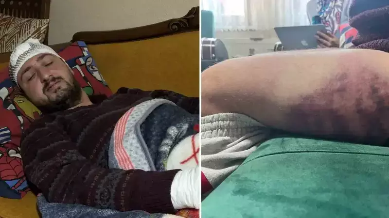 İzmit'te Otizmli Gence Saldıran Fırın Çalışanı Tutuklandı