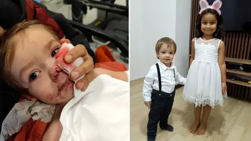 Etimesgut'ta Pitbull Saldırısı: 2 Çocuk Yaralandı, Sahibine 12 Şikayet