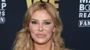 Brandi Glanville'in Yüzündeki Eriyen Görünümün Nedeni Sonunda Açıklandı