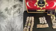 Siirt'te 4 Kaçakçının Midesinden 1,5 Kilo Uyuşturucu Çıkarıldı