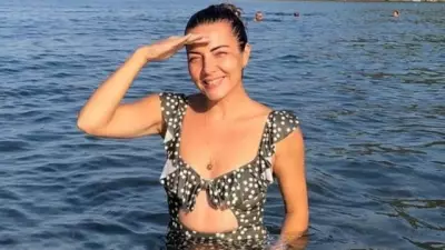 Burcu Kara Estetik Trendlerini Eleştirdi: 'Herkes Aynı Dudak, Aynı Burun'
