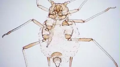 Kaz Dağları'nda Yeni Bir Böcek Türü Keşfedildi: Aphis dardanelliensis