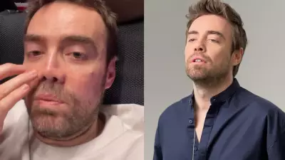 Murat Dalkılıç: 'İki Sene Sonra Nihayet Burnum Oldu'