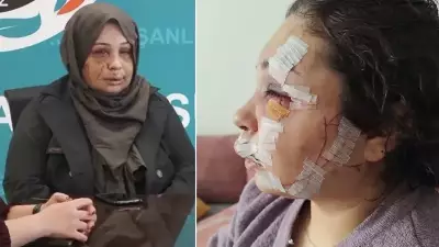 Polis Memuru Eşinin Yüzünü Kesti, Mahkemede Şok İddialar Ortaya Çıktı