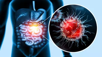 Sessiz Tehdit: Kolon Kanserinin En Yaygın Belirtileri ve Risk Faktörleri Açıklandı