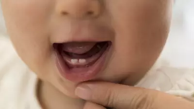 Süt Dişlerinin Gizli Görevi: Çocuk Gelişimindeki Kritik Rolü