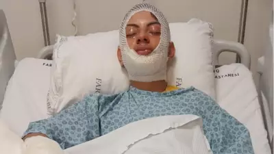 Trabzon'da Ateşe Benzin Dökme Kazası: Genç Adam Ölümden Döndü