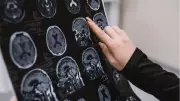 Alzheimer Hastalarının Üçte İkisi Kadın: Menopoz ve Erken Tanı Kritik Önemde