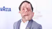 Oscar'ın Yıldızı Adam Pearson: Önyargıları Mizahla Yerle Bir Etti