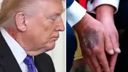 Trump'ın Boynundaki Kırmızı İz, Sağlık Tartışmalarını Alevlendirdi