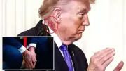 Trump'ın Boynundaki Kızarıklık Kremdenmiş: Doktoru Açıkladı
