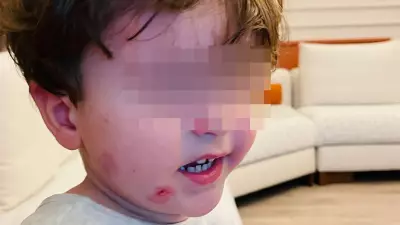 Bursa'da 2,5 Yaşındaki Çocuk Kreşte Darp Edildi: Gözetmen Öğretmen Yoktu