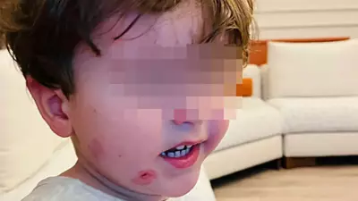 Bursa'da Kreş Skandalı: 2,5 Yaşındaki Çocuk Darp Edilmiş Halde Bulundu