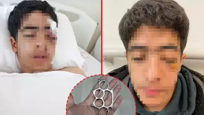 Esenyurt'ta akran zorbalığı: 'Şaka yapma' diyene muştalı saldırı, göz kaybı riski