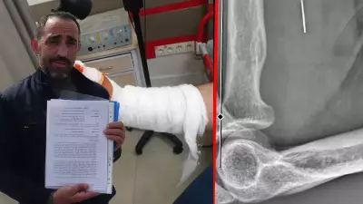 Kocaeli'de Kurban Bayramı Kazası: Yanlış Tedavi İddialarıyla Parmağını Kaybeden Adamın Dramı