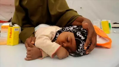 Nijerya'da kızamık salgını: 15 çocuk hayatını kaybetti