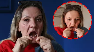 Sivas'ta 25 dişi çekilen kadının çenesinde iltihap oluştu