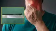 Boğazında 12 Santimlik Metal Çubukla 8 Yıl Yaşayan Adamın İnanılmaz Hikayesi