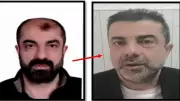 Cinayet Azmettiren Barış Mirza, Yüzünü Değiştirip Kardeşinin Kimliğiyle Yakalandı