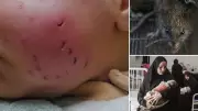 Gazze'de Haşere İstilası: Çadırlarda Yaşayanlar İçin Yeni Bir Kabus