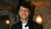 Sinan Özen Botoks İddialarına 'Ufak Bir Dokunuştu' Yanıtını Verdi