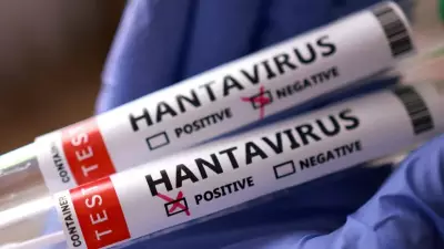 BM'den hantavirüs açıklaması: Genel nüfus için risk düşük