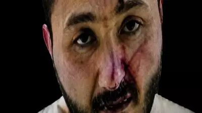 Şehit Polislerin Katil Zanlısı Şizofreni Hastası Çıktı