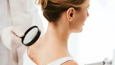 Yaz gelmeden dermatologlardan cilt kanseri uyarısı: Güneş düşündüğünüzden daha tehlikeli
